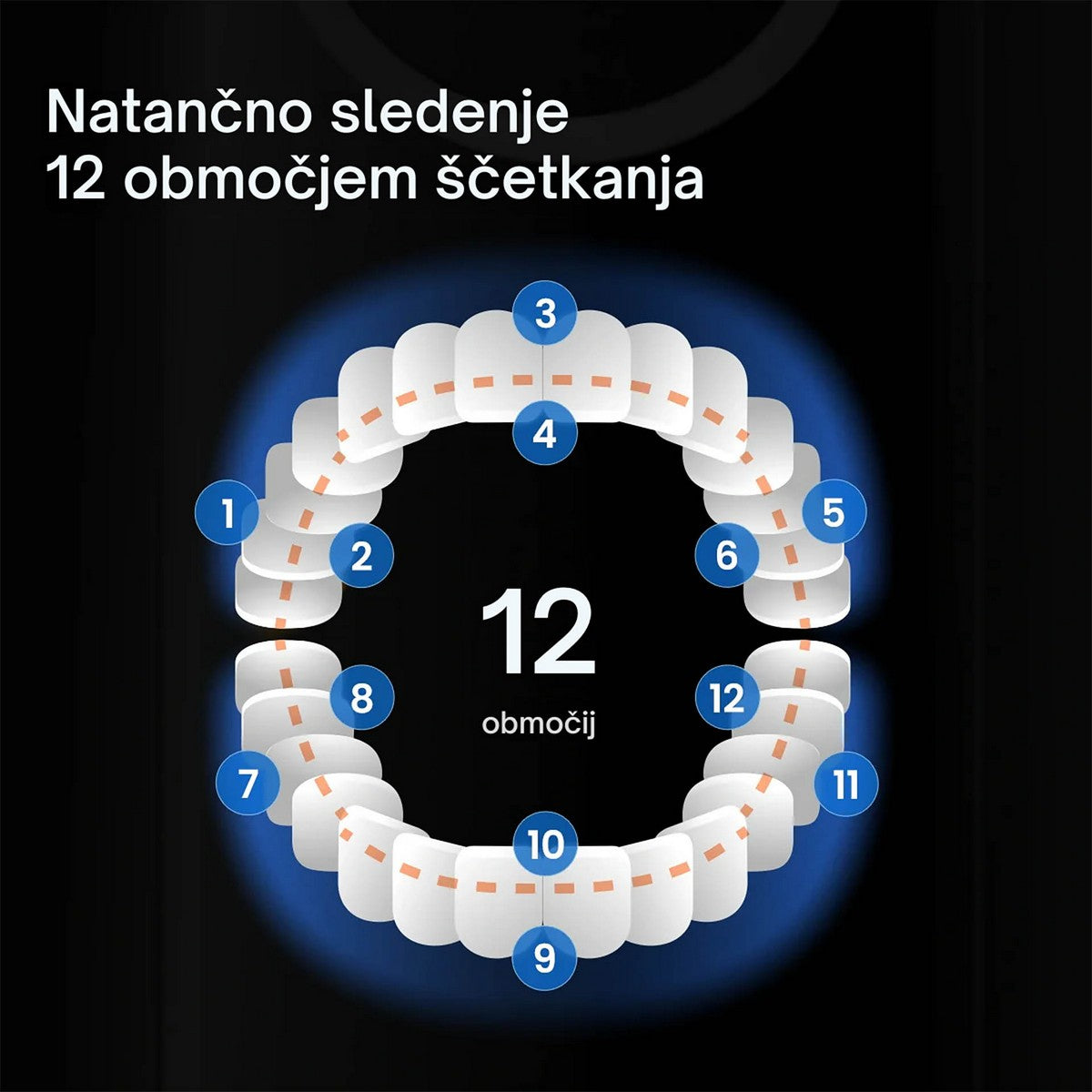 OClean Električna Četkica za zube X Pro 20 - BIJELA